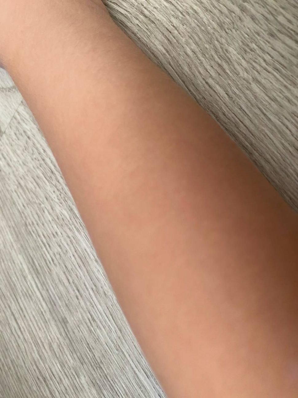 В Котласе 5-летняя девочка сломала руку на батуте